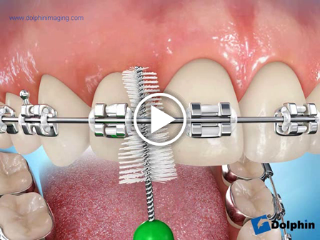 Brushing with Proxabrush